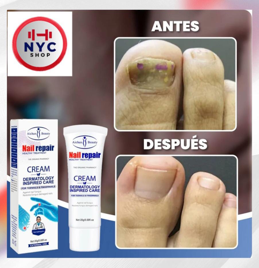 ELIMINA HONGOS DE UÑAS DE PIES Y MANOS